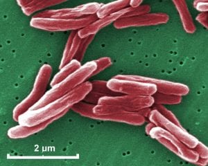 mycobacterium tuberculosis 030